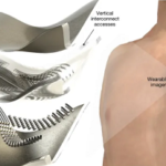 Giyilebilir Ultrason Yaması, Hareket Halindeyken Gerçek Zamanlı Kalp Taramaları Sunabilir